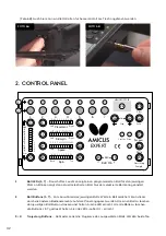 Preview for 32 page of Butterfly Amicus Expert Owner'S Manual