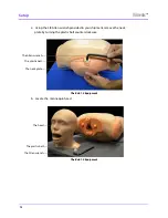 Preview for 44 page of CAE Healthcare Vimedix Abdo User Manual