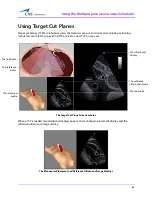 Preview for 89 page of CAE Healthcare Vimedix Abdo User Manual