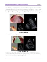 Preview for 90 page of CAE Healthcare Vimedix Abdo User Manual