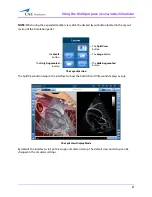 Preview for 113 page of CAE Healthcare Vimedix Abdo User Manual