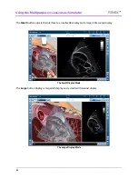 Preview for 114 page of CAE Healthcare Vimedix Abdo User Manual