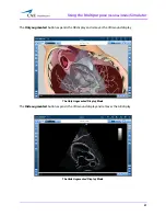 Preview for 115 page of CAE Healthcare Vimedix Abdo User Manual