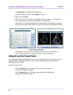 Preview for 120 page of CAE Healthcare Vimedix Abdo User Manual