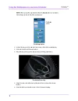 Preview for 124 page of CAE Healthcare Vimedix Abdo User Manual