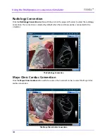 Preview for 128 page of CAE Healthcare Vimedix Abdo User Manual