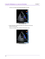 Preview for 158 page of CAE Healthcare Vimedix Abdo User Manual