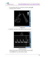 Preview for 165 page of CAE Healthcare Vimedix Abdo User Manual