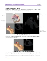 Preview for 218 page of CAE Healthcare Vimedix Abdo User Manual