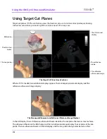 Preview for 342 page of CAE Healthcare Vimedix Abdo User Manual