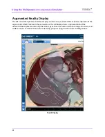 Preview for 58 page of CAE Healthcare Vimedix Cardiac User Manual