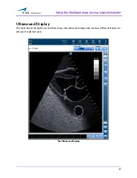 Preview for 63 page of CAE Healthcare Vimedix Cardiac User Manual