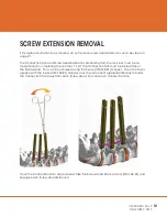 Preview for 19 page of CAMBER ORTHROS MIS Surgical Technique Manual