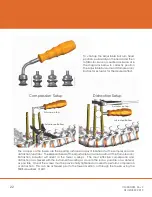 Preview for 22 page of CAMBER ORTHROS MIS Surgical Technique Manual