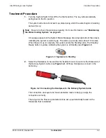 Preview for 67 page of Candela AlexTriVantage Operator'S Manual