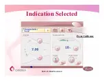 Предварительный просмотр 39 страницы Candela Vbeam Perfecta Manual