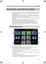 Preview for 121 page of Canon OCT-A1 Operation Manual