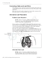 Preview for 70 page of Cardiac Science Atria 3100 Operating Instructions Manual