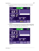 Preview for 87 page of CareFusion Infant Flow LP SiPAP Service Manual