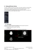 Preview for 16 page of Carestream Vue PACS MR Diffusion User Manual