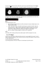 Preview for 17 page of Carestream Vue PACS MR Diffusion User Manual