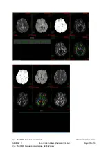 Preview for 18 page of Carestream Vue PACS MR Diffusion User Manual