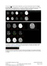 Preview for 19 page of Carestream Vue PACS MR Diffusion User Manual