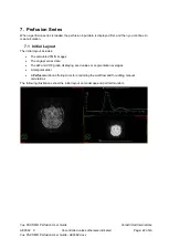 Preview for 22 page of Carestream Vue PACS MR Diffusion User Manual