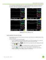 Preview for 51 page of CASMED fore-sight elite User Manual