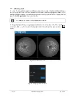 Preview for 29 page of CenterVue COMPASS Operating Manual