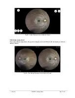 Preview for 33 page of CenterVue COMPASS Operating Manual