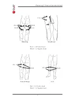 Предварительный просмотр 19 страницы Chattanooga Primera Operation Manual