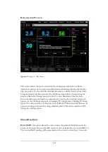 Preview for 42 page of Cheetah Medical Starling SV User Manual