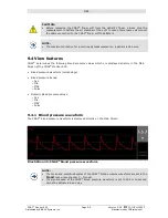 Preview for 75 page of CNSystems CNAP Monitor 500 HD Operator'S Manual