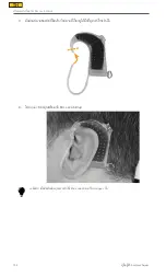 Preview for 134 page of Cochlear Aqua+ User Manual