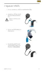 Preview for 135 page of Cochlear Aqua+ User Manual