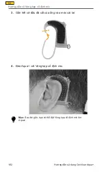 Preview for 162 page of Cochlear Aqua+ User Manual