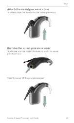 Preview for 47 page of Cochlear CP1110 User Manual