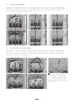 Preview for 4 page of CommScope Mini-OTE 200 Series Installation Instruction