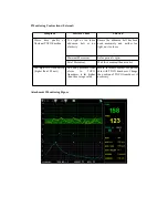 Preview for 30 page of Contec CMS800G User Manual