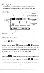 Preview for 16 page of Contec CMS80A Instructions To User