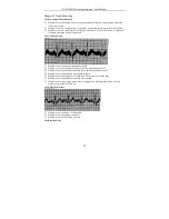 Предварительный просмотр 36 страницы Contec ECG1200G User Manual