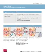 COOK Medical ShortShot Quick Reference Manual предпросмотр