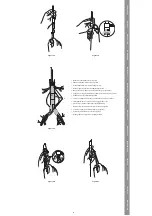 Предварительный просмотр 21 страницы COOK Medical Zenith Fenestrated AAA Instructions For Use Manual