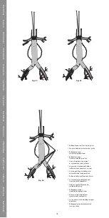 Preview for 18 page of COOK Medical Zenith Flex Series Instructions For Use Manual