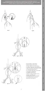 Preview for 19 page of COOK Medical Zenith Flex Series Instructions For Use Manual