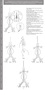 Preview for 20 page of COOK Medical Zenith Flex Series Instructions For Use Manual