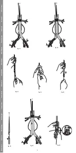 Предварительный просмотр 16 страницы COOK Medical Zenith Flex Instructions For Use Manual