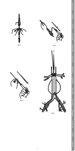 Предварительный просмотр 13 страницы COOK Medical Zenith Spiral-Z AAA Instructions For Use Manual