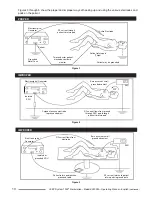 Предварительный просмотр 12 страницы Cooper Surgical LEEP System 1000 Operating Manual